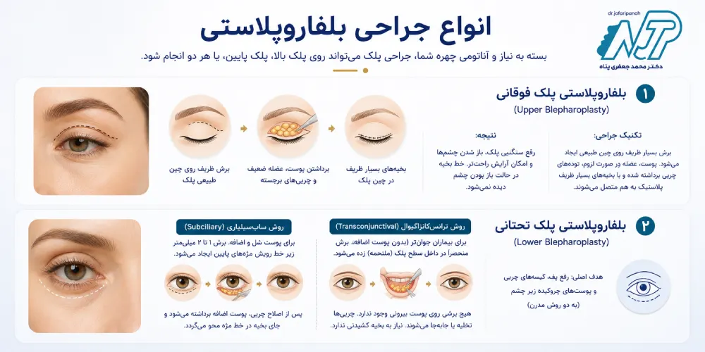 انواع جراحی بلفاروپلاستی