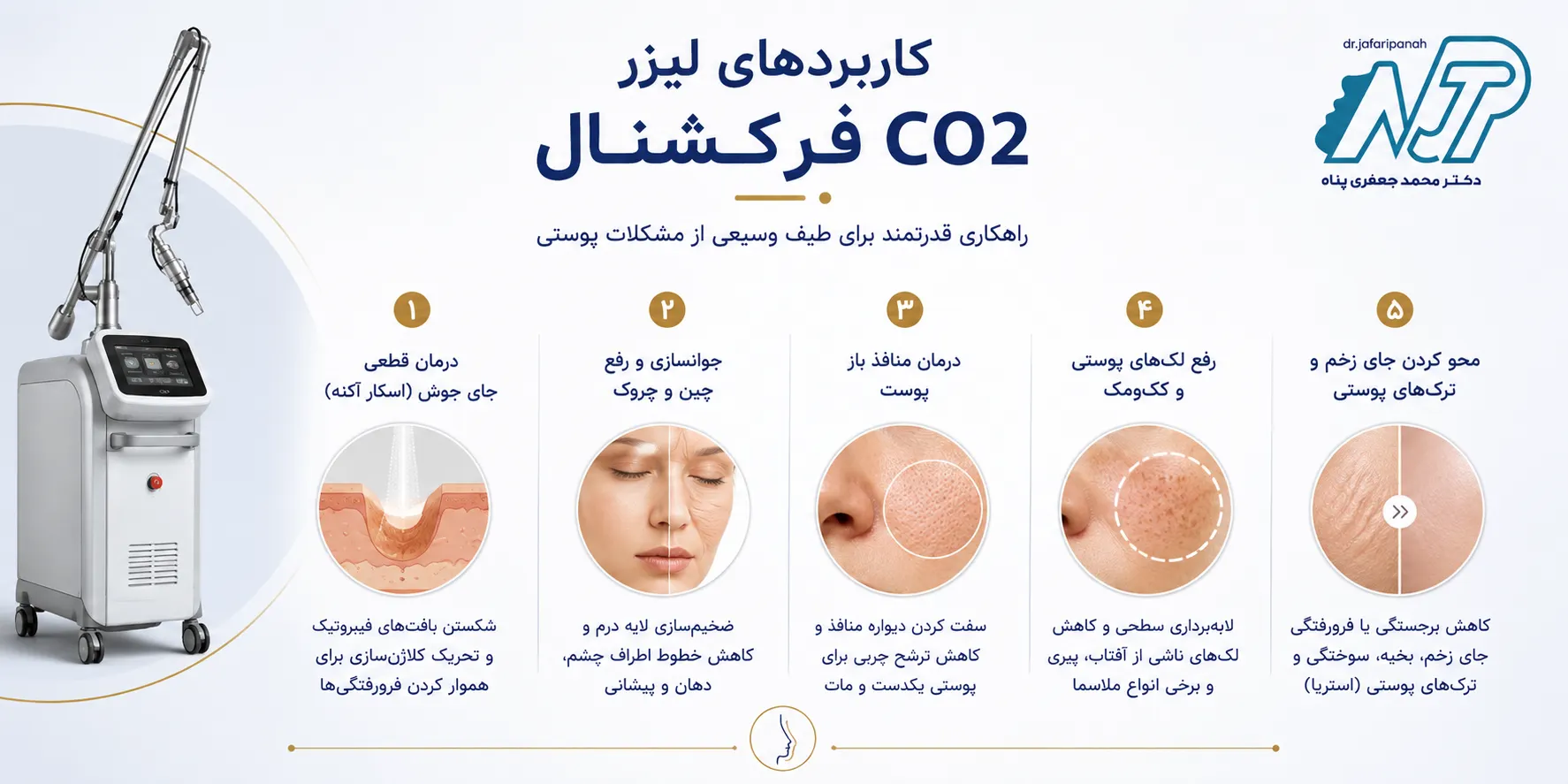 کاربردهای لیزر CO2 فرکشنال