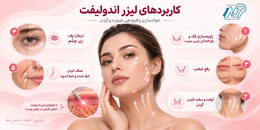 کاربردهای لیزر اندولیفت
