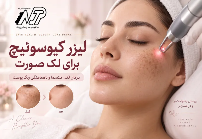 لیزر کیوسوئیچ چیست؟