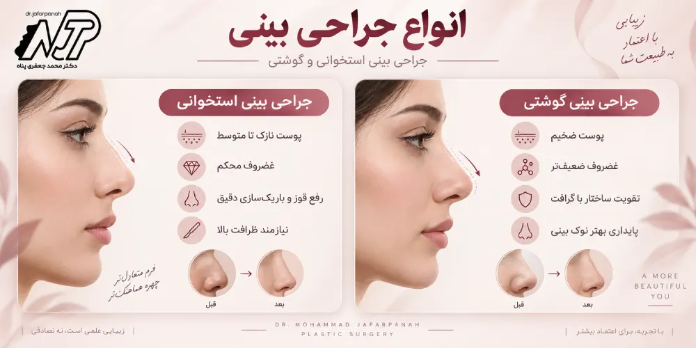 انواع جراحی بینی