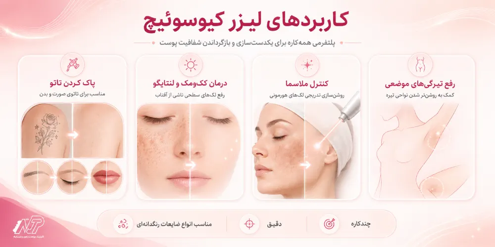 کاربردهای لیزر کیوسوئیچ